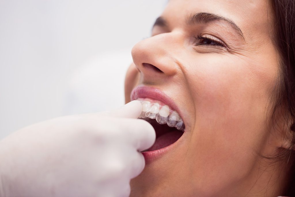 Zahnknirschen - Behandlung